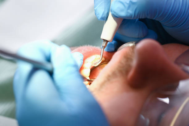 Best Emergency Treatment for Dental Infections or Abscesses in Headland, AL